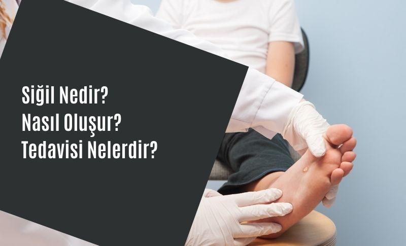 Siğil Nedir? Nasıl Oluşur? Tedavisi Nelerdir?